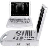 Portable ultrasound scanner with color Doppler convex probe and screen for 128 elements